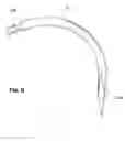 Fig. 09 - Implant for Bone Fixation