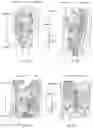 Fig. 06 - SURGICAL PATH PLANNING USING ARTIFICIAL INTELLIGENCE FOR FEATURE DETECTION