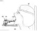 Fig. 03 - DENTAL TREATMENT ROBOT