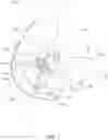 Fig. 02 - ORTHOPEDIC APPLIANCE