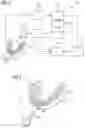 Fig. 04 - DENTAL SPLINT AND METHOD FOR PRODUCING SAME