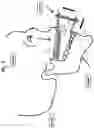Fig. 04 - UPPER JAW FITTING ELEMENT FOR FITTING TO A HUMAN UPPER JAW