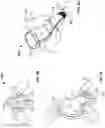 Fig. 06 - Surgical delivery devices, systems, and methods