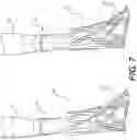 Fig. 07 - Interventional device having an integrated embolic filter and associated methods
