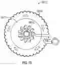 Fig. 77 - Methods for docking a heart valve
