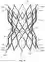 Fig. 24 - Devices and systems for docking a heart valve