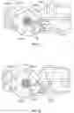 Fig. 76 - Devices and systems for docking a heart valve
