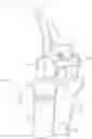 Fig. 01 - Elbow joint prostheses