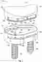 Fig. 02 - Glenoid implant systems and methods of using the same