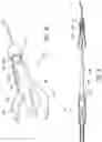 Fig. 07 - LUMINAL STENTING