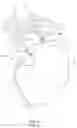 Fig. 07 - Adjustable implant and method of use