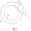 Fig. 08 - Adjustable implant and method of use