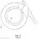 Fig. 09 - Adjustable implant and method of use