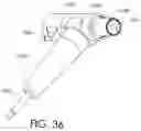 Fig. 37 - Adjustable implant and method of use