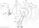 Fig. 40 - Adjustable implant and method of use