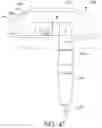 Fig. 43 - Adjustable implant and method of use