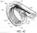 Fig. 44 - Adjustable implant and method of use