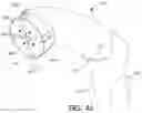 Fig. 48 - Adjustable implant and method of use