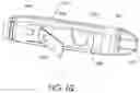 Fig. 64 - Adjustable implant and method of use