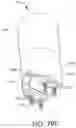 Fig. 83 - Adjustable implant and method of use