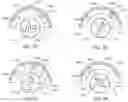Fig. 90 - Adjustable implant and method of use
