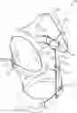 Fig. 01 - POSTURE CORRECTION BRACE