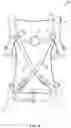 Fig. 10 - POSTURE CORRECTION BRACE