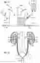Fig. 15 - Urine Collecting System Interventions For Improving Kidney Function
