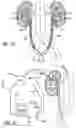 Fig. 16 - Urine Collecting System Interventions For Improving Kidney Function
