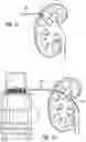 Fig. 17 - Urine Collecting System Interventions For Improving Kidney Function