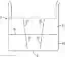 Fig. 01 - Drainable ostomy pouch including closure members and method of making the same