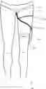 Fig. 01 - Female Urinary Catheter System
