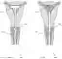 Fig. 06 - Female Urinary Catheter System