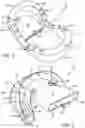 Fig. 02 - DEVICE AND METHOD FOR HELPING PREVENT SNORING AND SLEEP APNEA