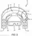 Fig. 03 - DEVICE AND METHOD FOR HELPING PREVENT SNORING AND SLEEP APNEA