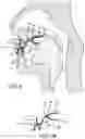 Fig. 04 - DEVICE AND METHOD FOR HELPING PREVENT SNORING AND SLEEP APNEA