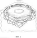 Fig. 02 - EYE STENTS AND DELIVERY SYSTEMS