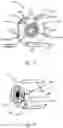 Fig. 02 - Adjustable flow glaucoma shunts and associated systems and methods