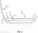 Fig. 06 - Multimodality medical procedure mattress-based device