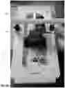 Fig. 47 - SHORT ARC, HIGH FREQUENCY CONSTANT PASSIVE MOTION MACHINES AND METHODOLOGIES