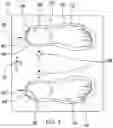 Fig. 03 - Achilles tendon massage assembly