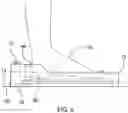 Fig. 06 - Achilles tendon massage assembly