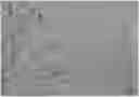 Fig. 01 - Method for preparing probiotic-loaded microcapsule, product obtained from the same, and use of the same