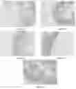 Fig. 07 - Method for preparing probiotic-loaded microcapsule, product obtained from the same, and use of the same