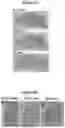 Fig. 11 - METHODS AND COMPOSITIONS FOR TREATMENT OF L YSOSOMAL STORAGE DISORDER