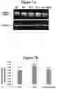 Fig. 14 - METHODS AND COMPOSITIONS FOR TREATMENT OF L YSOSOMAL STORAGE DISORDER