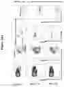Fig. 17 - METHODS AND COMPOSITIONS FOR TREATMENT OF L YSOSOMAL STORAGE DISORDER