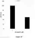 Fig. 04 - USE OF HEXOKINASE 2/MITOCHONDRIA-DETACHING COMPOUNDS FOR TREATING HEXOKINASE-2 (HK2)-EXPRESSING CANCERS