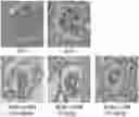 Fig. 01 - PHARMACEUTICAL COMPOSITION FOR PREVENTING AND TREATING DIABETIC NEPHROPAPHY INCLUDING ADENOSINE DERIVATIVE
