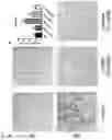 Fig. 12 - PHARMACEUTICAL COMPOSITION FOR PREVENTING AND TREATING DIABETIC NEPHROPAPHY INCLUDING ADENOSINE DERIVATIVE